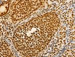 Phospho-AKT1 (Ser124) Antibody in Immunohistochemistry (Paraffin) (IHC (P))