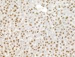 Phospho-AKT1 (Ser124) Antibody in Immunohistochemistry (Paraffin) (IHC (P))