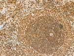 Phospho-AKT1 (Ser124) Antibody in Immunohistochemistry (Paraffin) (IHC (P))