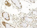 Phospho-AKT1 (Ser124) Antibody in Immunohistochemistry (Paraffin) (IHC (P))