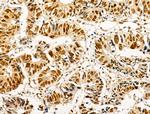 Phospho-AKT1 (Ser124) Antibody in Immunohistochemistry (Paraffin) (IHC (P))