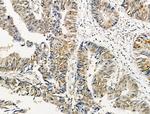 Phospho-AKT1 (Ser124) Antibody in Immunohistochemistry (Paraffin) (IHC (P))