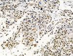 Phospho-AKT1 (Ser124) Antibody in Immunohistochemistry (Paraffin) (IHC (P))