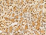 Phospho-AKT1 (Ser124) Antibody in Immunohistochemistry (Paraffin) (IHC (P))