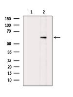 Phospho-AKT1 (Ser124) Antibody in Western Blot (WB)