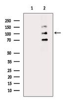 Phospho-SREBP1 (Ser396) Antibody in Western Blot (WB)