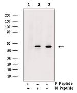 Phospho-Nkx2.1 (Ser327) Antibody in Western Blot (WB)