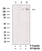 Phospho-TSC2 (Ser1387) Antibody in Western Blot (WB)