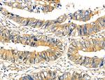 Phospho-TSC2 (Ser1387) Antibody in Immunohistochemistry (Paraffin) (IHC (P))