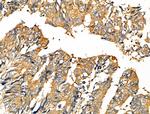 Phospho-TSC2 (Ser1387) Antibody in Immunohistochemistry (Paraffin) (IHC (P))