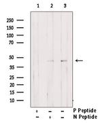 Phospho-CDK9 (Thr186) Antibody in Western Blot (WB)