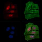 Phospho-IRAK1 (Thr100) Antibody in Immunocytochemistry (ICC/IF)