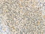 Phospho-IRAK1 (Thr100) Antibody in Immunohistochemistry (Paraffin) (IHC (P))