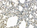 Phospho-IRAK1 (Thr209) Antibody in Immunohistochemistry (Paraffin) (IHC (P))