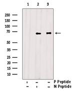 Phospho-ETK (Tyr40) Antibody in Western Blot (WB)