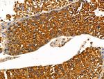 Phospho-KIF11 (Thr926) Antibody in Immunohistochemistry (Paraffin) (IHC (P))