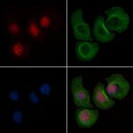 Phospho-FOXL2 (Ser238) Antibody in Immunocytochemistry (ICC/IF)