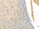 Phospho-FOXL2 (Ser238) Antibody in Immunohistochemistry (Paraffin) (IHC (P))