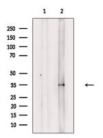 Phospho-PP2A alpha (Tyr307) Antibody in Western Blot (WB)