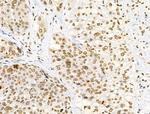 Phospho-FOXM1 (Ser35) Antibody in Immunohistochemistry (Paraffin) (IHC (P))