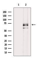 Phospho-PAK1/PAK2 (Thr423, Thr402) Antibody in Western Blot (WB)