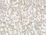 Phospho-PPIG (Ser376) Antibody in Immunohistochemistry (Paraffin) (IHC (P))