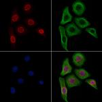 Phospho-ATR (Thr1989) Antibody in Immunocytochemistry (ICC/IF)