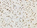 Phospho-BRK (Tyr447) Antibody in Immunohistochemistry (Paraffin) (IHC (P))