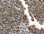 Phospho-BRK (Tyr447) Antibody in Immunohistochemistry (Paraffin) (IHC (P))