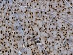 Phospho-BRK (Tyr447) Antibody in Immunohistochemistry (Paraffin) (IHC (P))