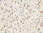 Phospho-BRK (Tyr447) Antibody in Immunohistochemistry (Paraffin) (IHC (P))