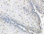 Phospho-BRK (Tyr447) Antibody in Immunohistochemistry (Paraffin) (IHC (P))