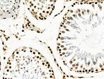 Phospho-BRK (Tyr447) Antibody in Immunohistochemistry (Paraffin) (IHC (P))