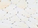 Phospho-BRK (Tyr447) Antibody in Immunohistochemistry (Paraffin) (IHC (P))