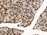 Phospho-BRK (Tyr447) Antibody in Immunohistochemistry (Paraffin) (IHC (P))