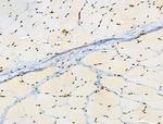 Phospho-BRK (Tyr447) Antibody in Immunohistochemistry (Paraffin) (IHC (P))