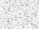 Phospho-BRK (Tyr447) Antibody in Immunohistochemistry (Paraffin) (IHC (P))