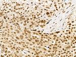 Phospho-RUNX2 (Ser340) Antibody in Immunohistochemistry (Paraffin) (IHC (P))