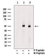 Phospho-IRF4 (Tyr122, Tyr125) Antibody in Western Blot (WB)