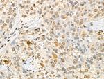 Phospho-RSK1 (Thr573) Antibody in Immunohistochemistry (Paraffin) (IHC (P))