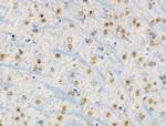 Phospho-RSK1 (Thr573) Antibody in Immunohistochemistry (Paraffin) (IHC (P))