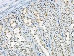 Phospho-RSK1 (Thr573) Antibody in Immunohistochemistry (Paraffin) (IHC (P))