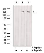 Phospho-GKAP1 (Ser25) Antibody in Western Blot (WB)