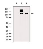 Phospho-GEF-H1 (Ser886) Antibody in Western Blot (WB)