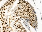 Phospho-PAR4 (Thr163) Antibody in Immunohistochemistry (Paraffin) (IHC (P))