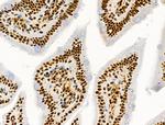 Phospho-MNK1 (Thr250, Thr255) Antibody in Immunohistochemistry (Paraffin) (IHC (P))