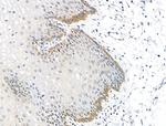 Phospho-PERK (Ser1096) Antibody in Immunohistochemistry (Paraffin) (IHC (P))