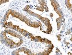 Phospho-PERK (Ser1096) Antibody in Immunohistochemistry (Paraffin) (IHC (P))