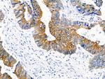 Phospho-PERK (Ser1096) Antibody in Immunohistochemistry (Paraffin) (IHC (P))