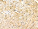 Phospho-PERK (Ser1096) Antibody in Immunohistochemistry (Paraffin) (IHC (P))